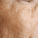 【乾燥肌 改善 札幌】季節の変わり目はエラスチンが重要！