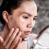 【体質改善 札幌】目のクマやくすみ「疲れ顔」の原因は足！？