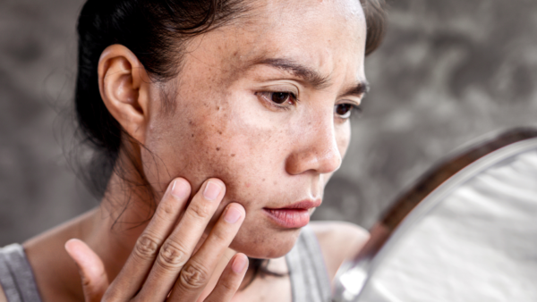 【体質改善 札幌】目のクマやくすみ「疲れ顔」の原因は足！？