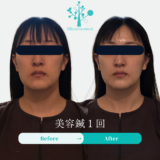 【くすみ改善 札幌】お顔の血色は足元から