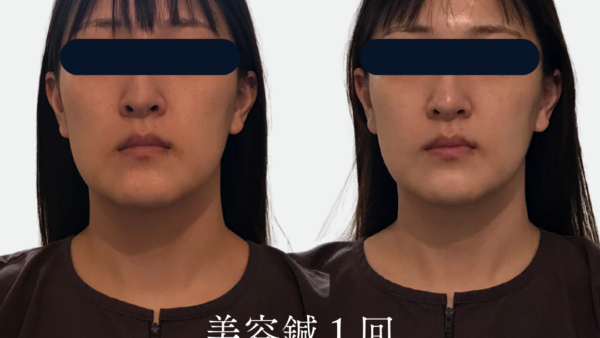 【くすみ改善 札幌】お顔の血色は足元から