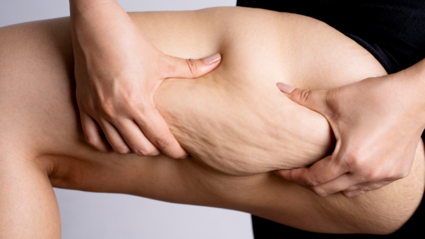 【足痩せ 札幌】ダイエットは「順番」が大切